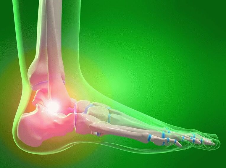 Osteoarthritis des Fußes