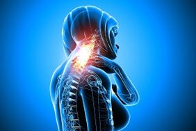 Osteochondrose in der Halsspalte